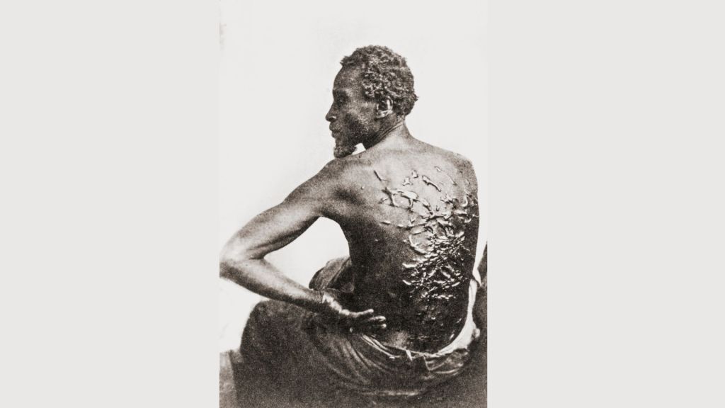 Trump Administration Orders Removal Of Famous Photo Of Enslaved Man’s Scars
